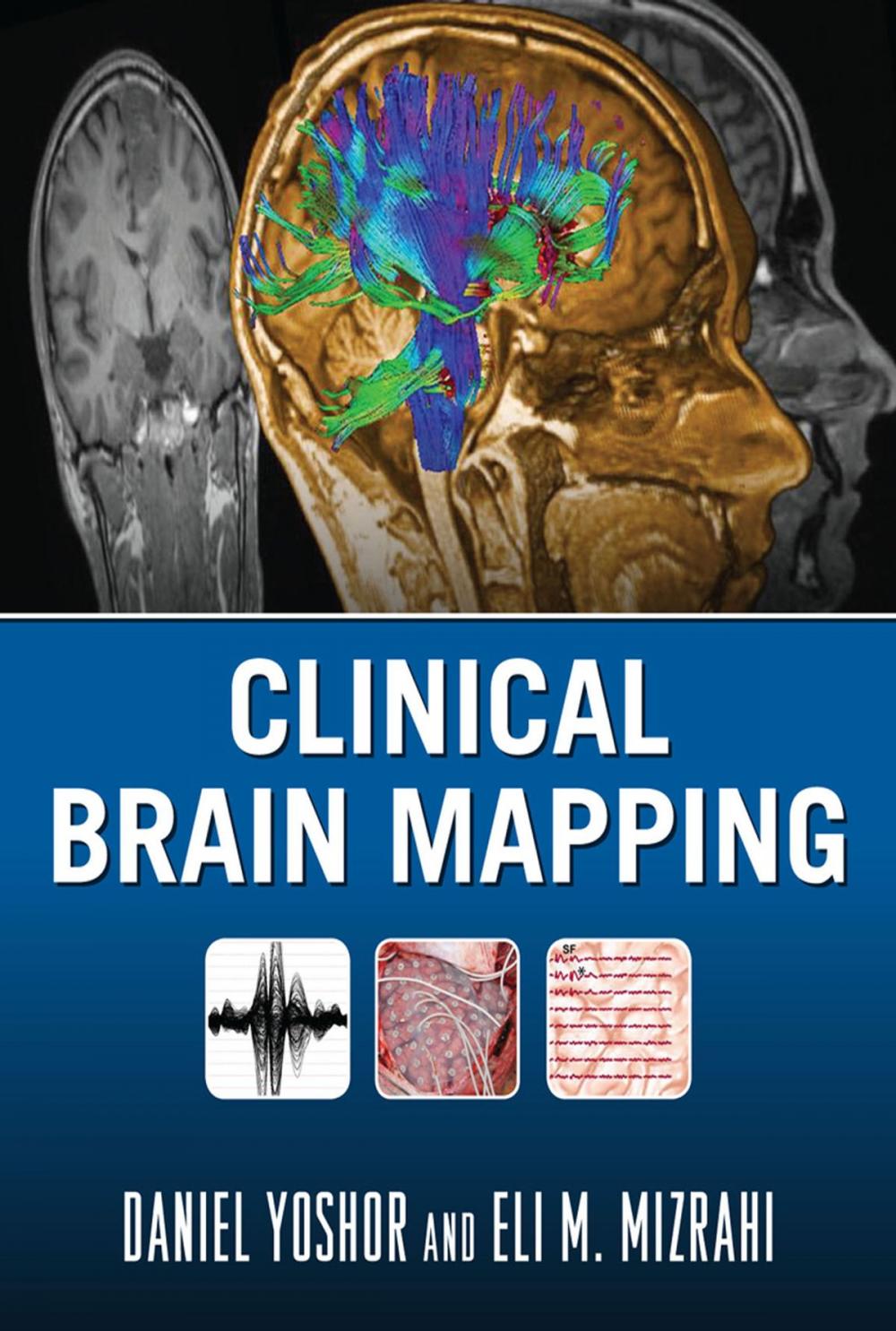 Big bigCover of Clinical Brain Mapping