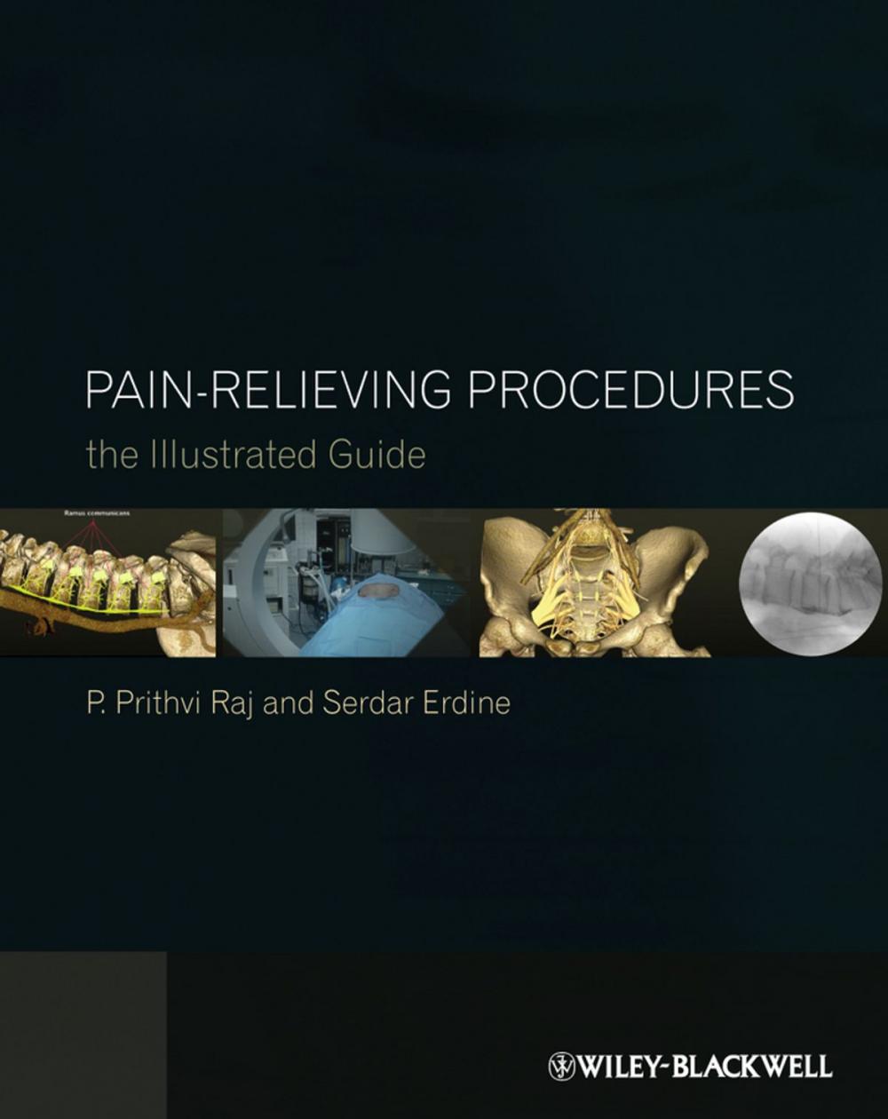 Big bigCover of Pain-Relieving Procedures