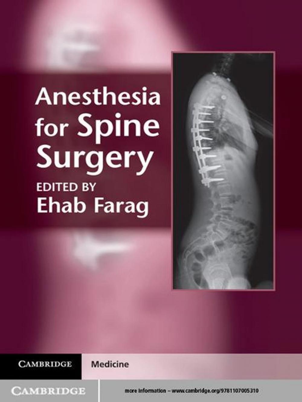 Big bigCover of Anesthesia for Spine Surgery