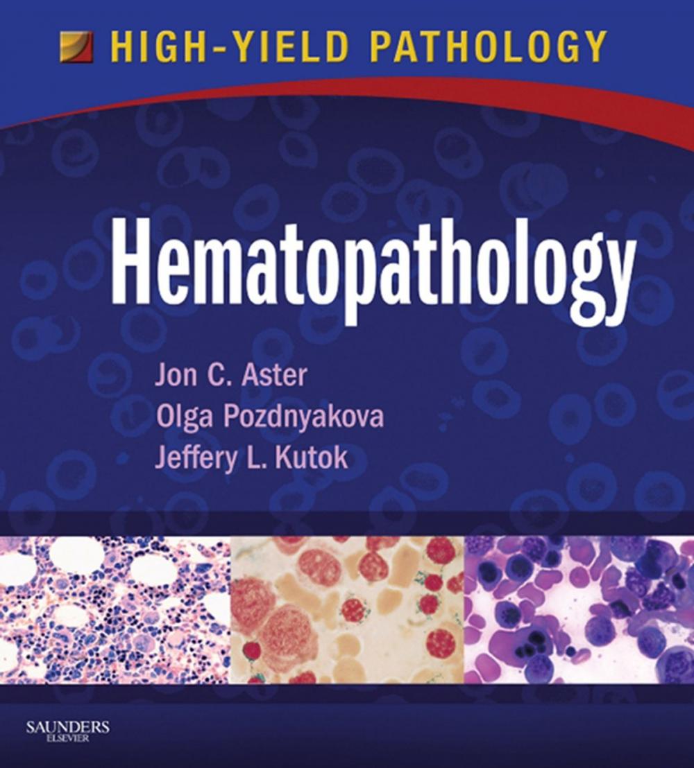 Big bigCover of Hematopathology E-Book