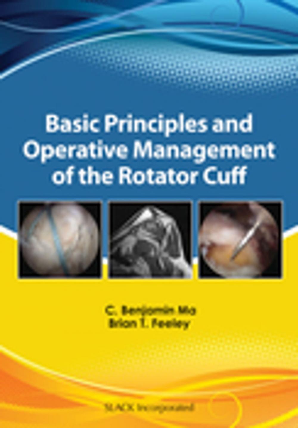 Big bigCover of Basic Principles and Operative Management of the Rotator Cuff