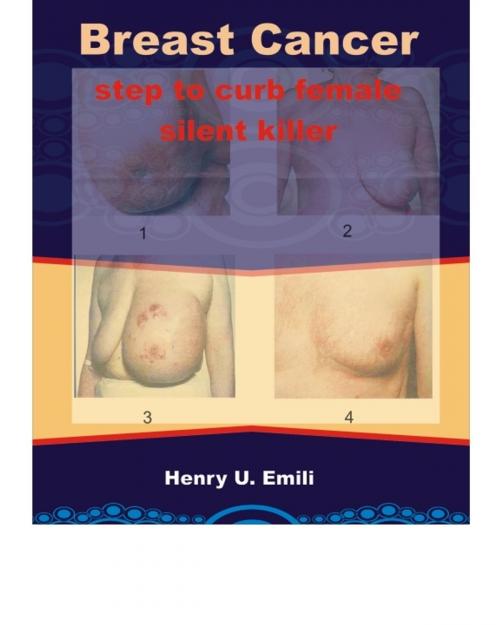 Cover of the book Breast Cancer: Step to curb female silent killer by Henry Emili, Henry Emili