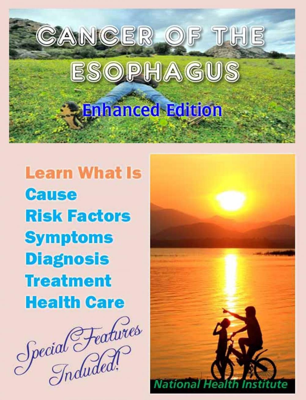 Big bigCover of Cancer of the Esophagus