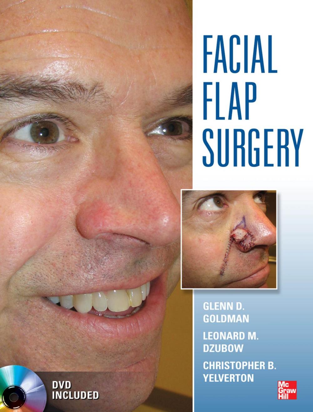 Big bigCover of Facial Flaps Surgery