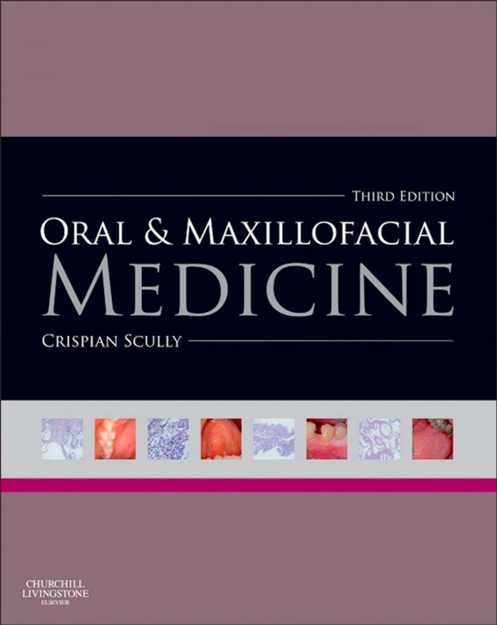 Big bigCover of Oral and Maxillofacial Medicine - E-Book