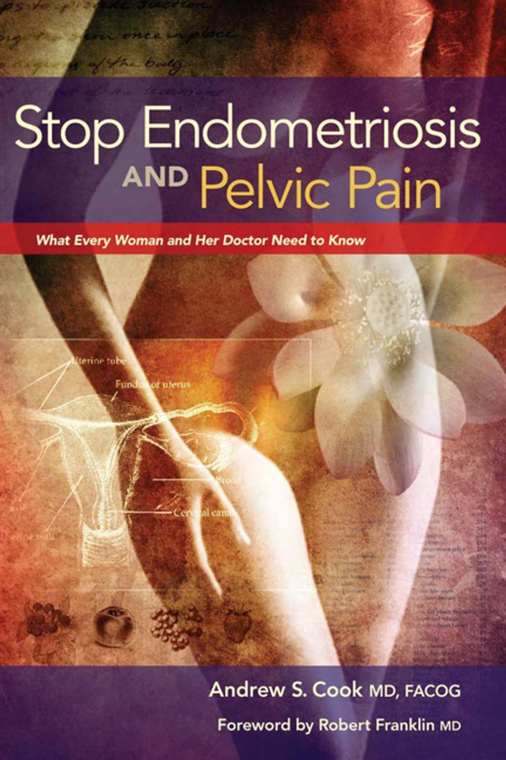 Big bigCover of Stop Endometriosis and Pelvic Pain