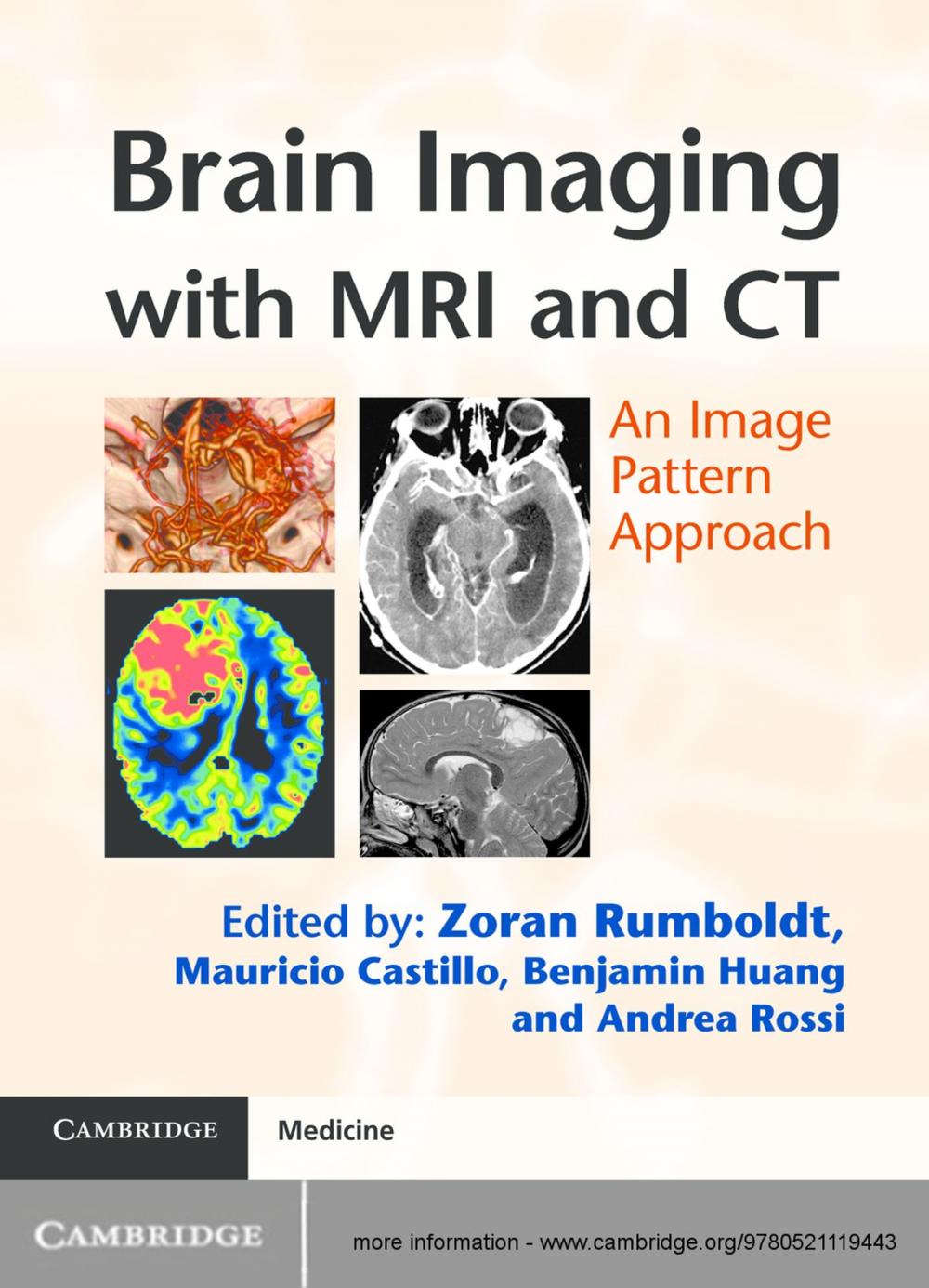 Big bigCover of Brain Imaging with MRI and CT