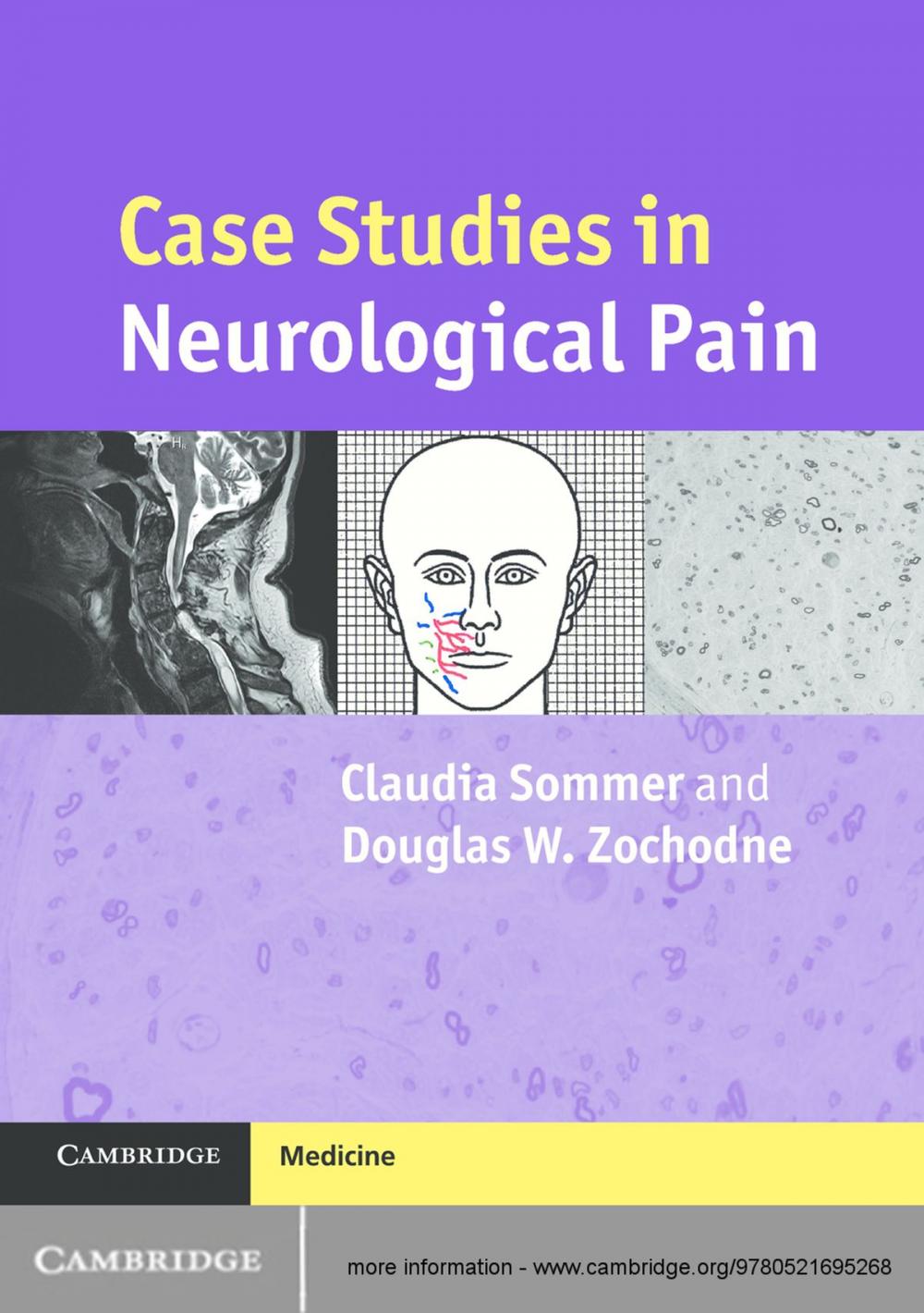 Big bigCover of Case Studies in Neurological Pain