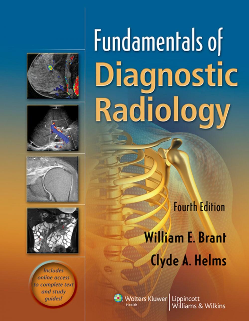 Big bigCover of Fundamentals of Diagnostic Radiology