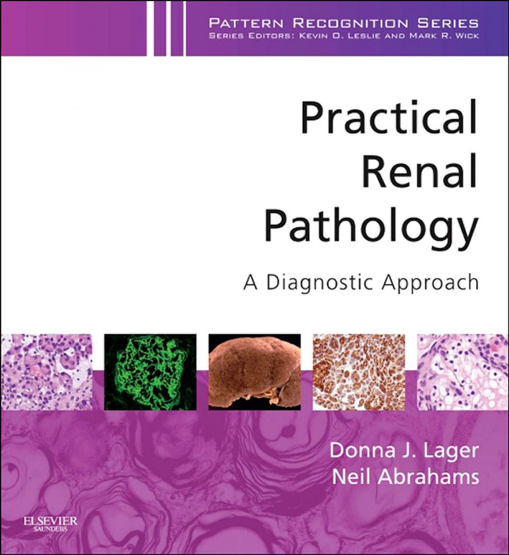 Big bigCover of Practical Renal Pathology, A Diagnostic Approach E-Book