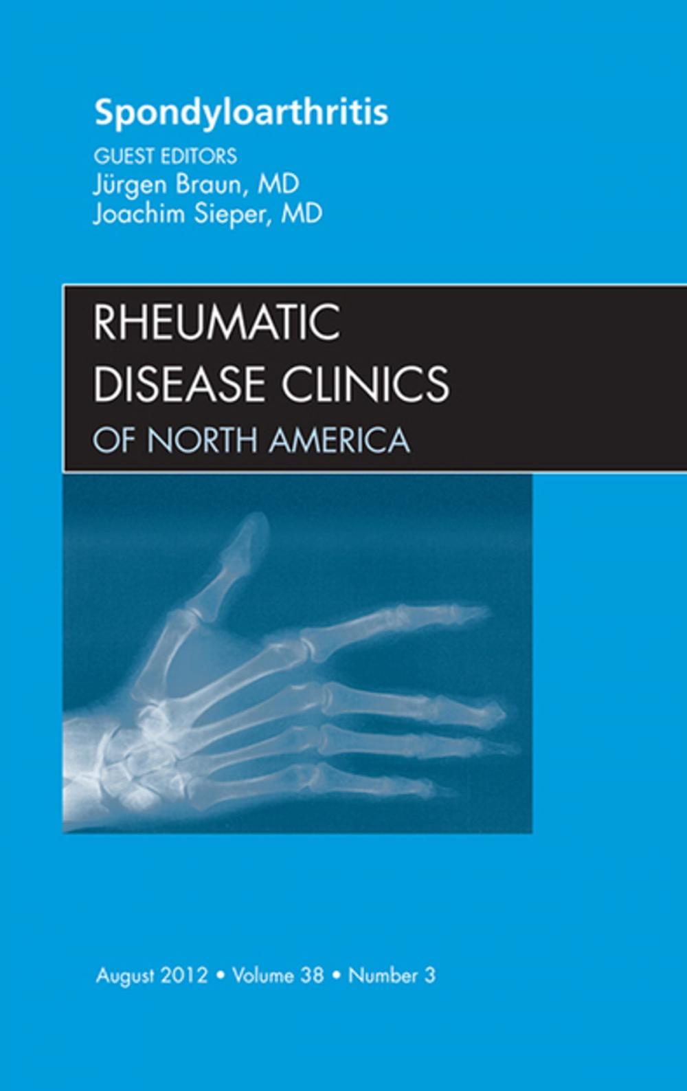 Big bigCover of Spondyloarthropathies, An Issue of Rheumatic Disease Clinics - E-Book