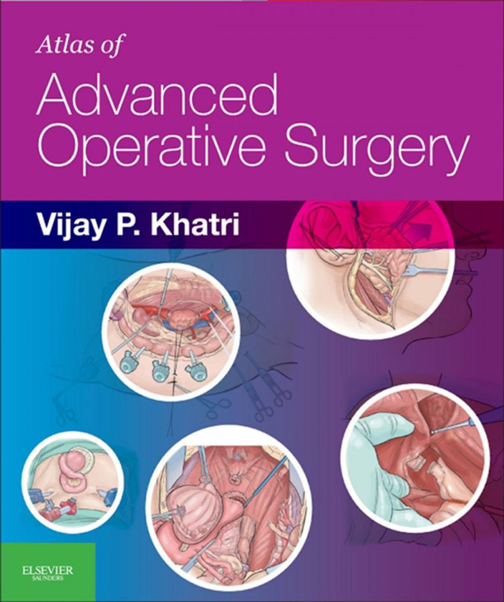 Big bigCover of Atlas of Advanced Operative Surgery E-Book