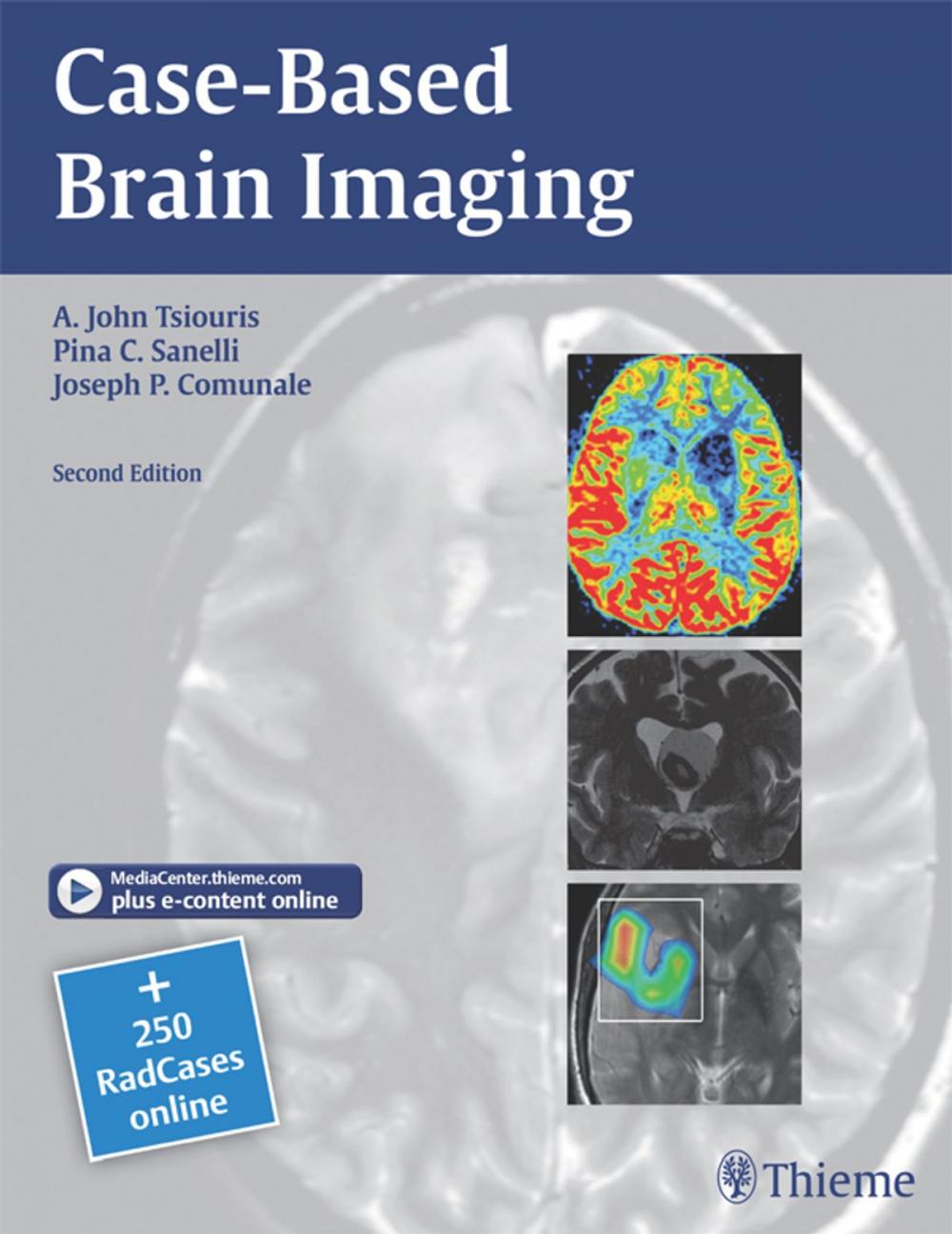 Big bigCover of Case-Based Brain Imaging