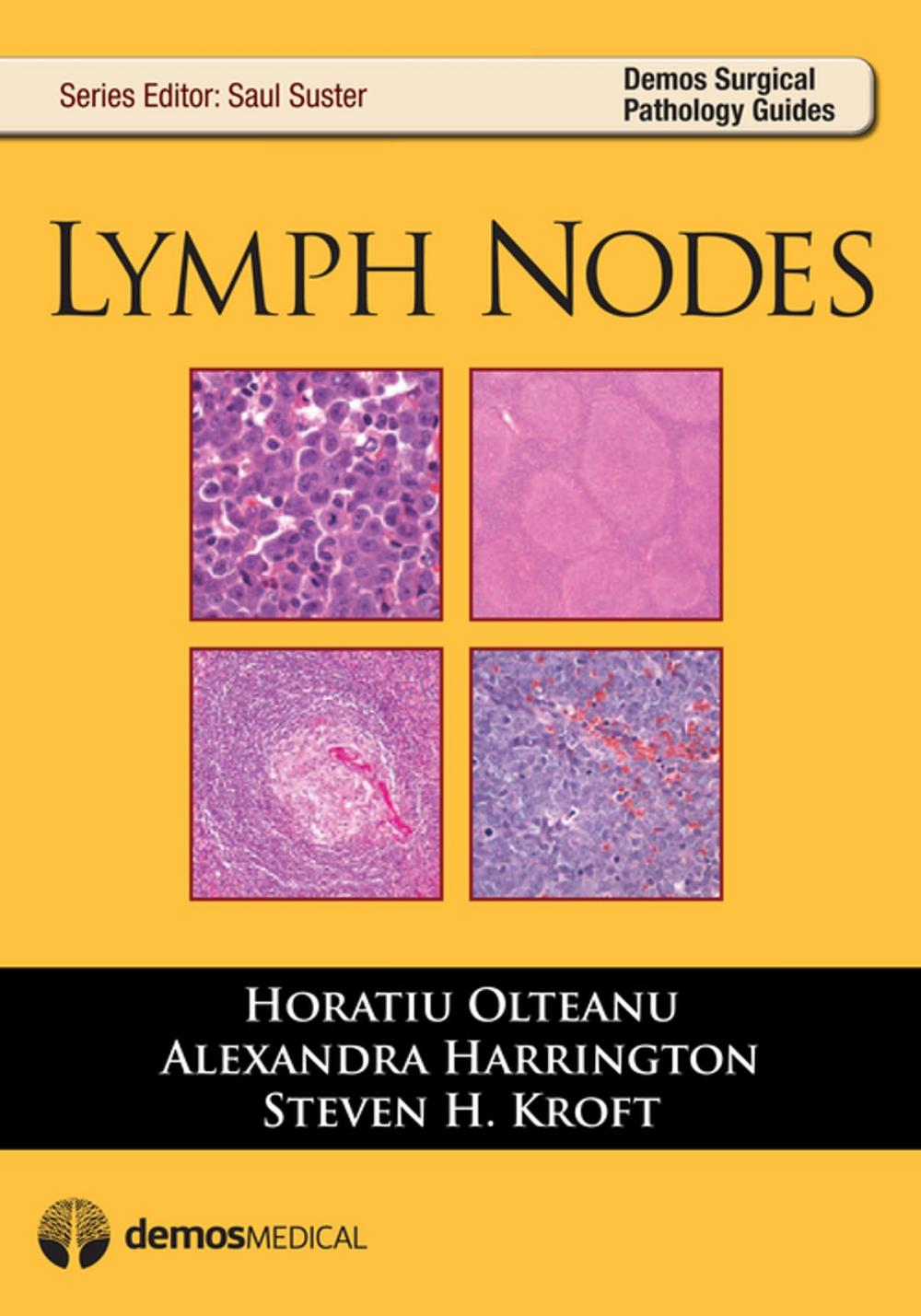 Big bigCover of Lymph Nodes