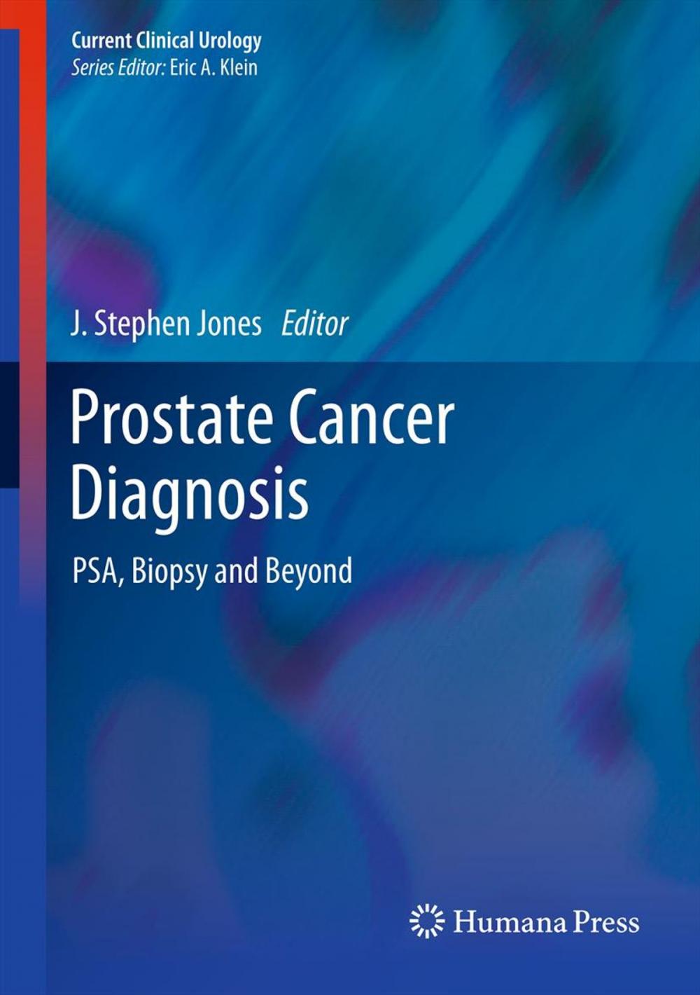 Big bigCover of Prostate Cancer Diagnosis