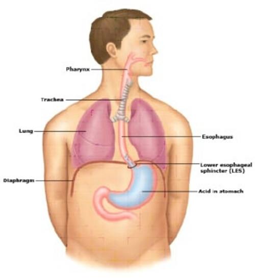 Cover of the book An Informative Guide About Barrett's Esophagus by Carol Gandolfini, Axel Publishing