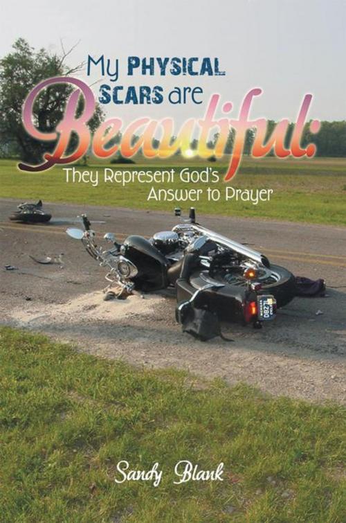 Cover of the book My Physical Scars Are Beautiful: by Sandy Blank, WestBow Press