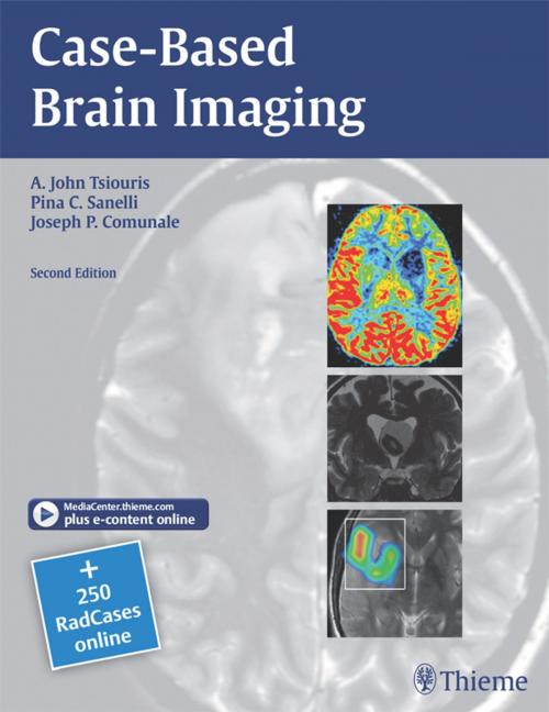 Cover of the book Case-Based Brain Imaging by A. John Tsiouris, Joseph P. Comunale, Pina C. Sanelli, Thieme