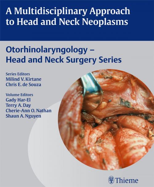 Cover of the book Multidisciplinary Approach to Head and Neck Neoplasms by , Thieme