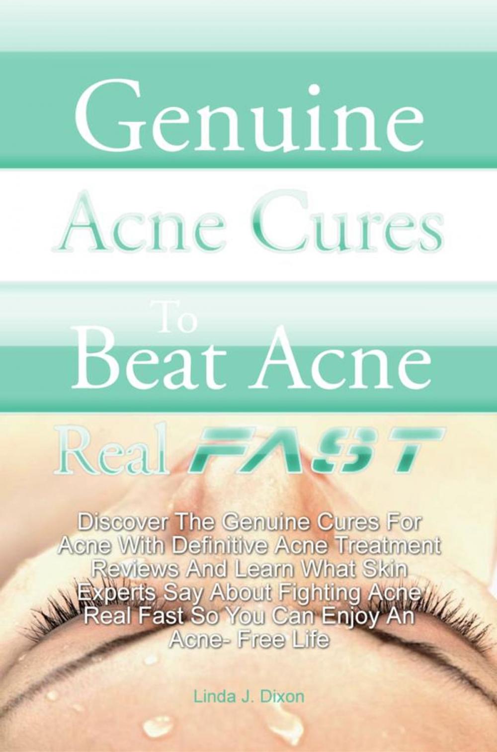 Big bigCover of Genuine Acne Cures To Beat Acne Real Fast