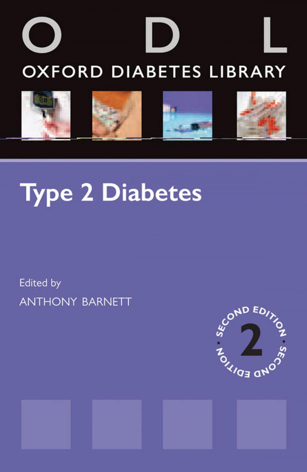 Big bigCover of Type 2 Diabetes