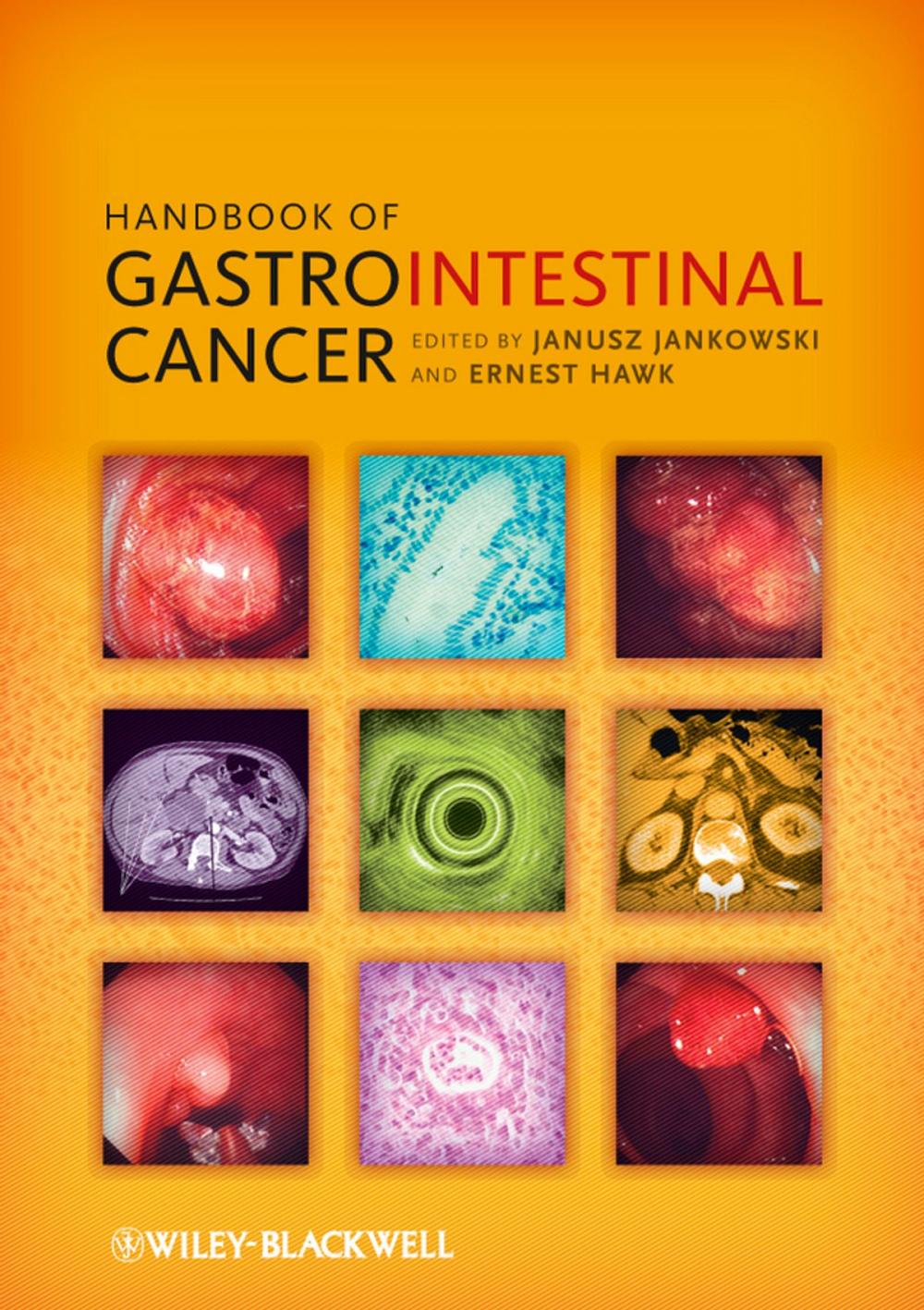 Big bigCover of Handbook of Gastrointestinal Cancer