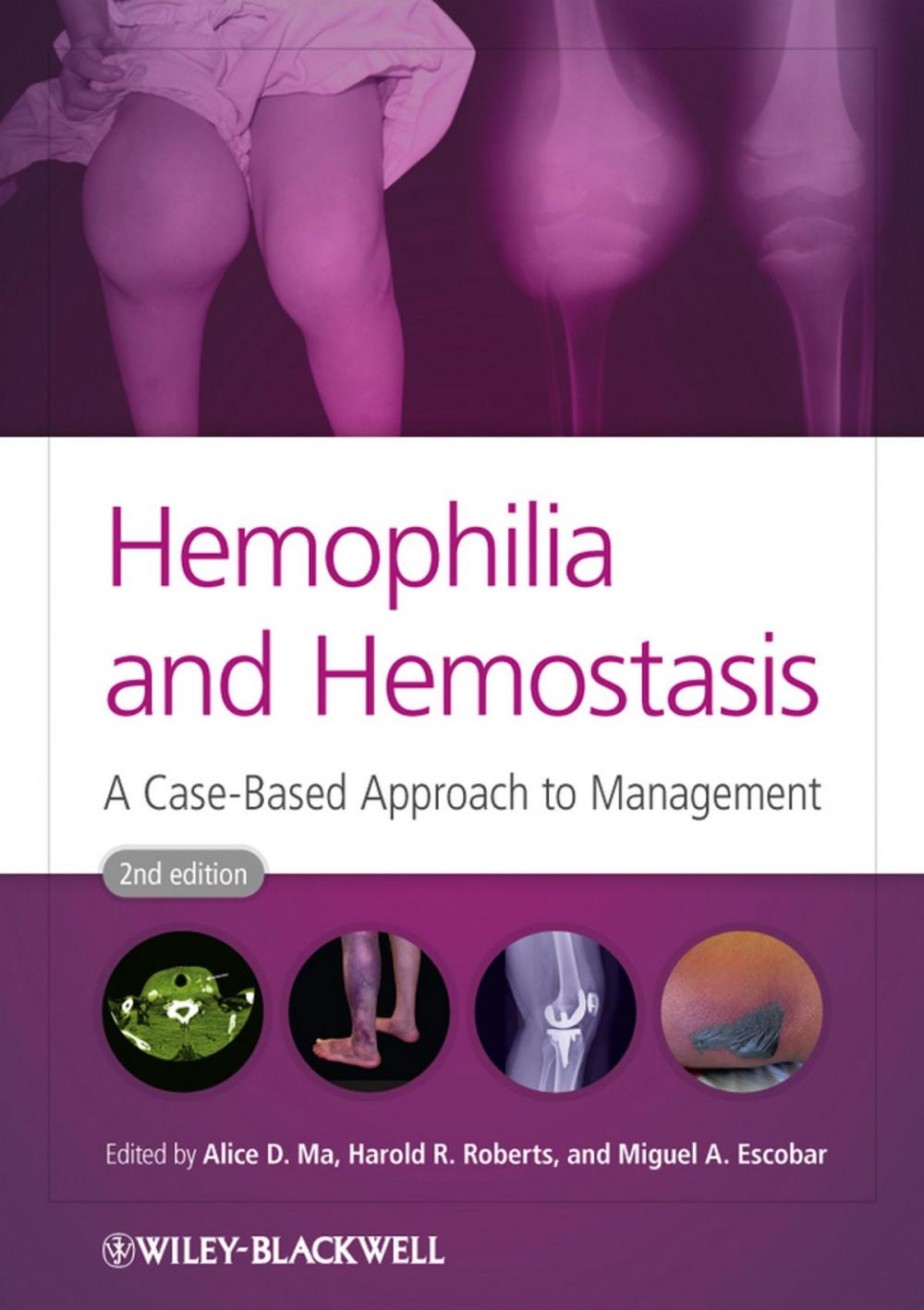 Big bigCover of Hemophilia and Hemostasis