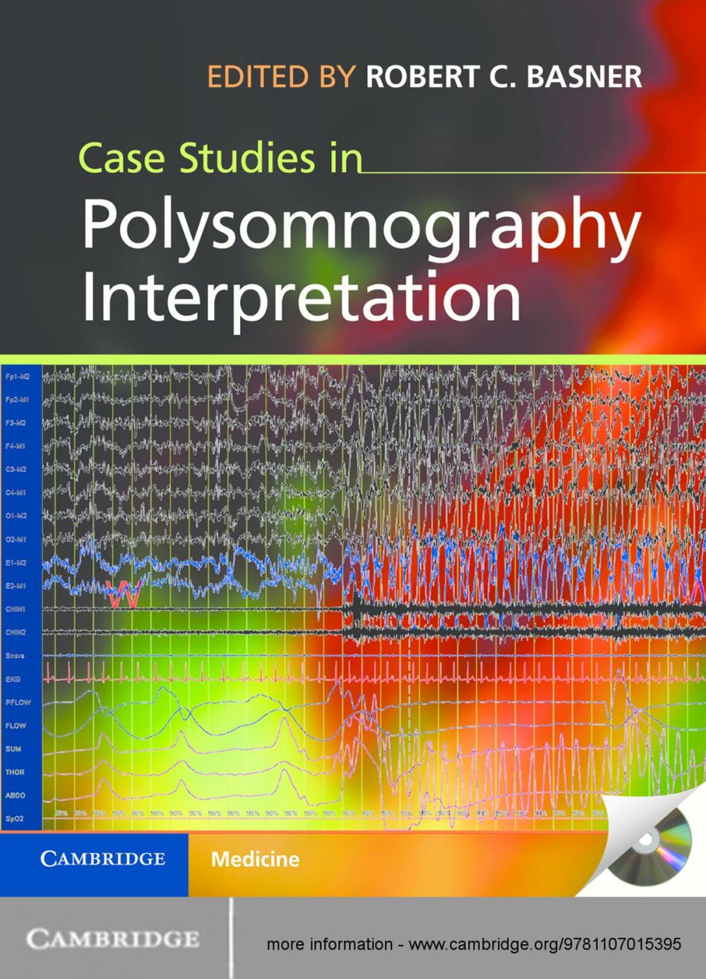 Big bigCover of Case Studies in Polysomnography Interpretation