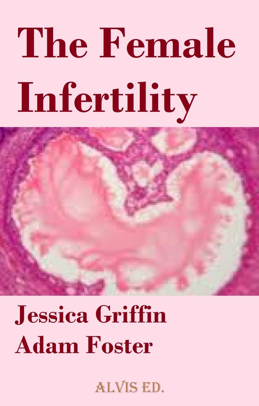 Big bigCover of The Female Infertility