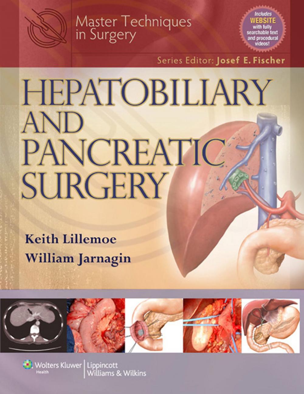 Big bigCover of Master Techniques in Surgery: Hepatobiliary and Pancreatic Surgery