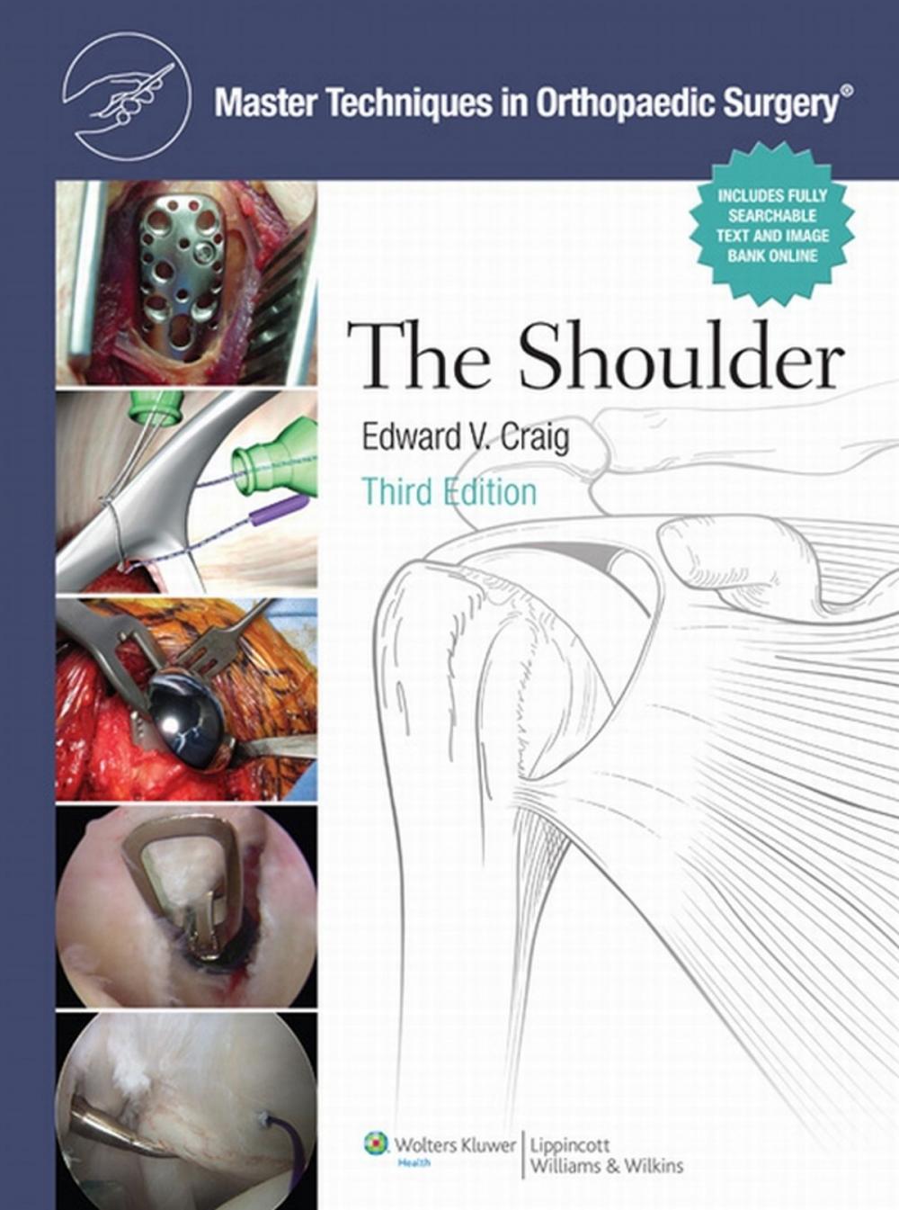 Big bigCover of The Master Techniques in Orthopaedic Surgery: Shoulder