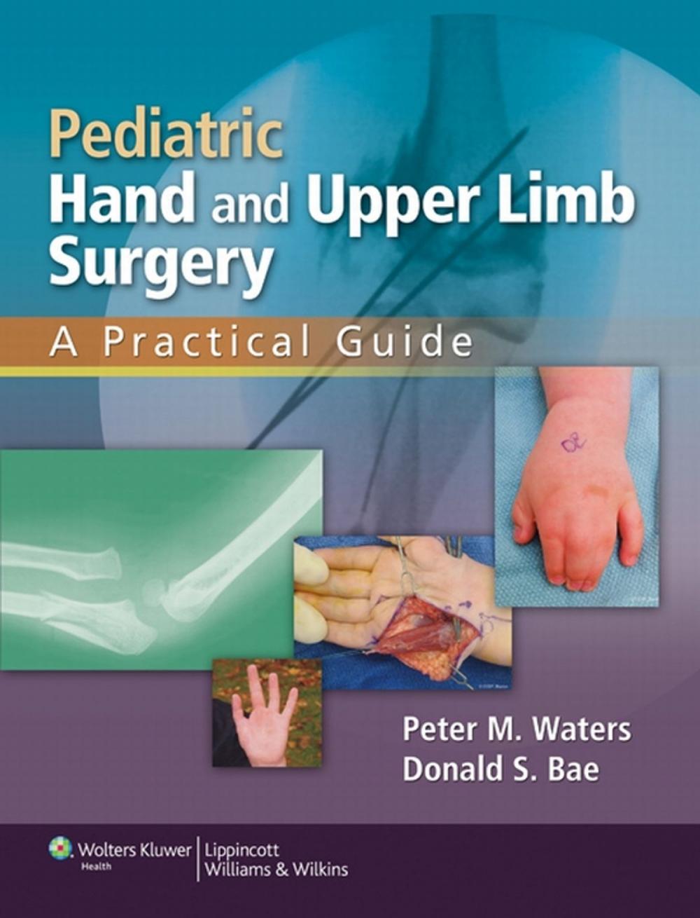 Big bigCover of Pediatric Hand and Upper Limb Surgery