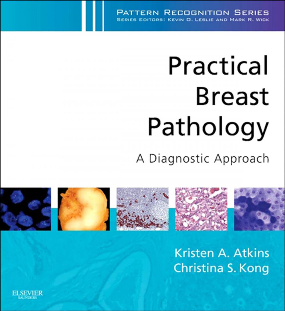 Big bigCover of Practical Breast Pathology: A Diagnostic Approach E-Book