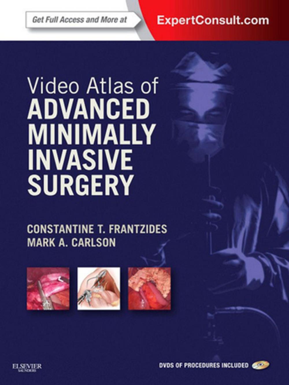 Big bigCover of Video Atlas of Advanced Minimally Invasive Surgery E-Book