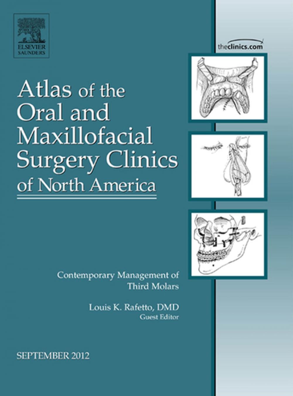 Big bigCover of Contemporary Management of Third Molars, An Issue of Atlas of the Oral and Maxillofacial Surgery Clinics