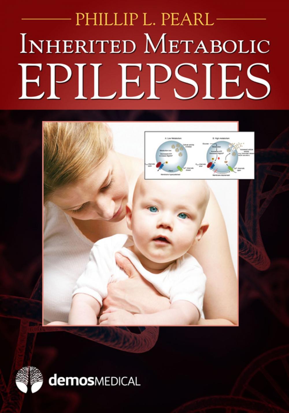 Big bigCover of Inherited Metabolic Epilepsies