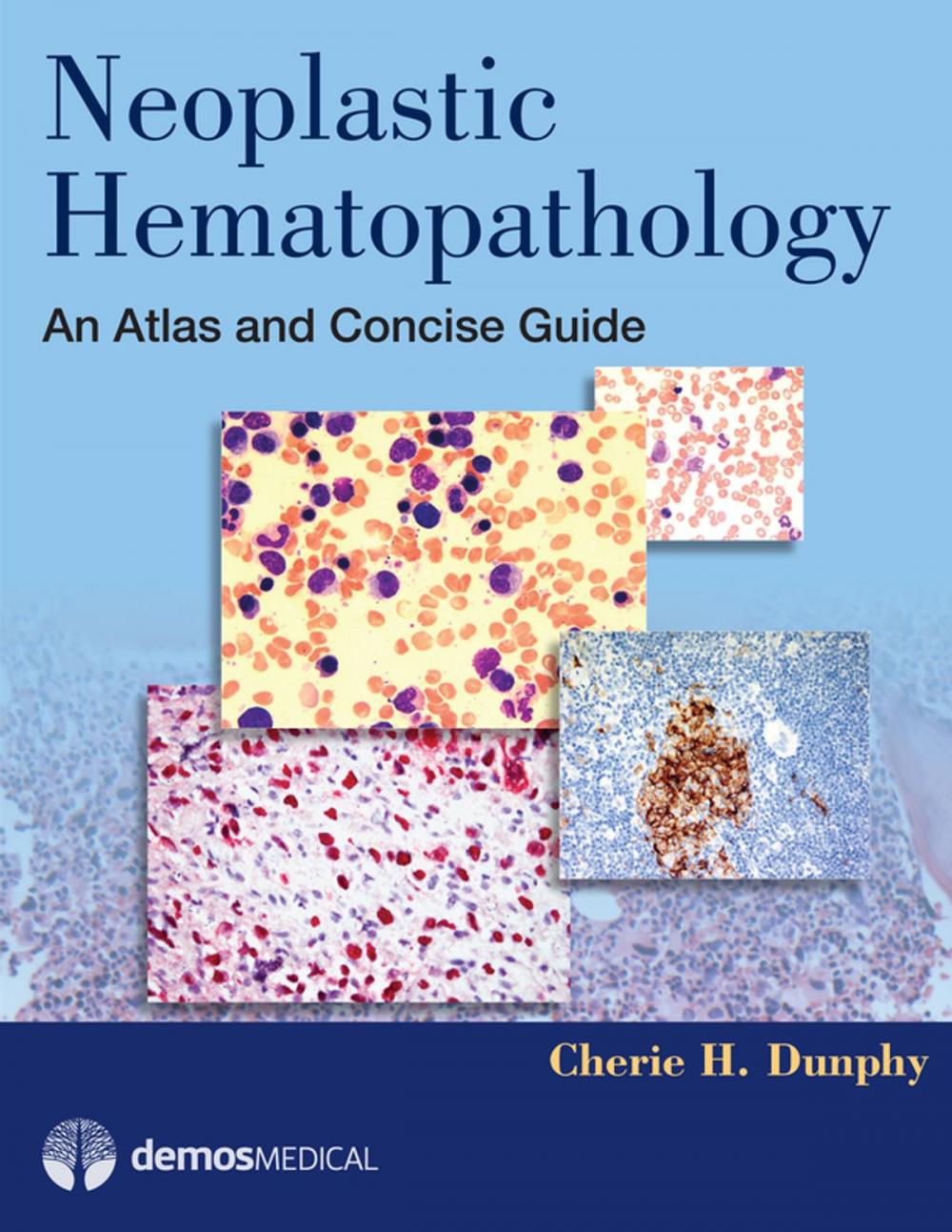 Big bigCover of Neoplastic Hematopathology