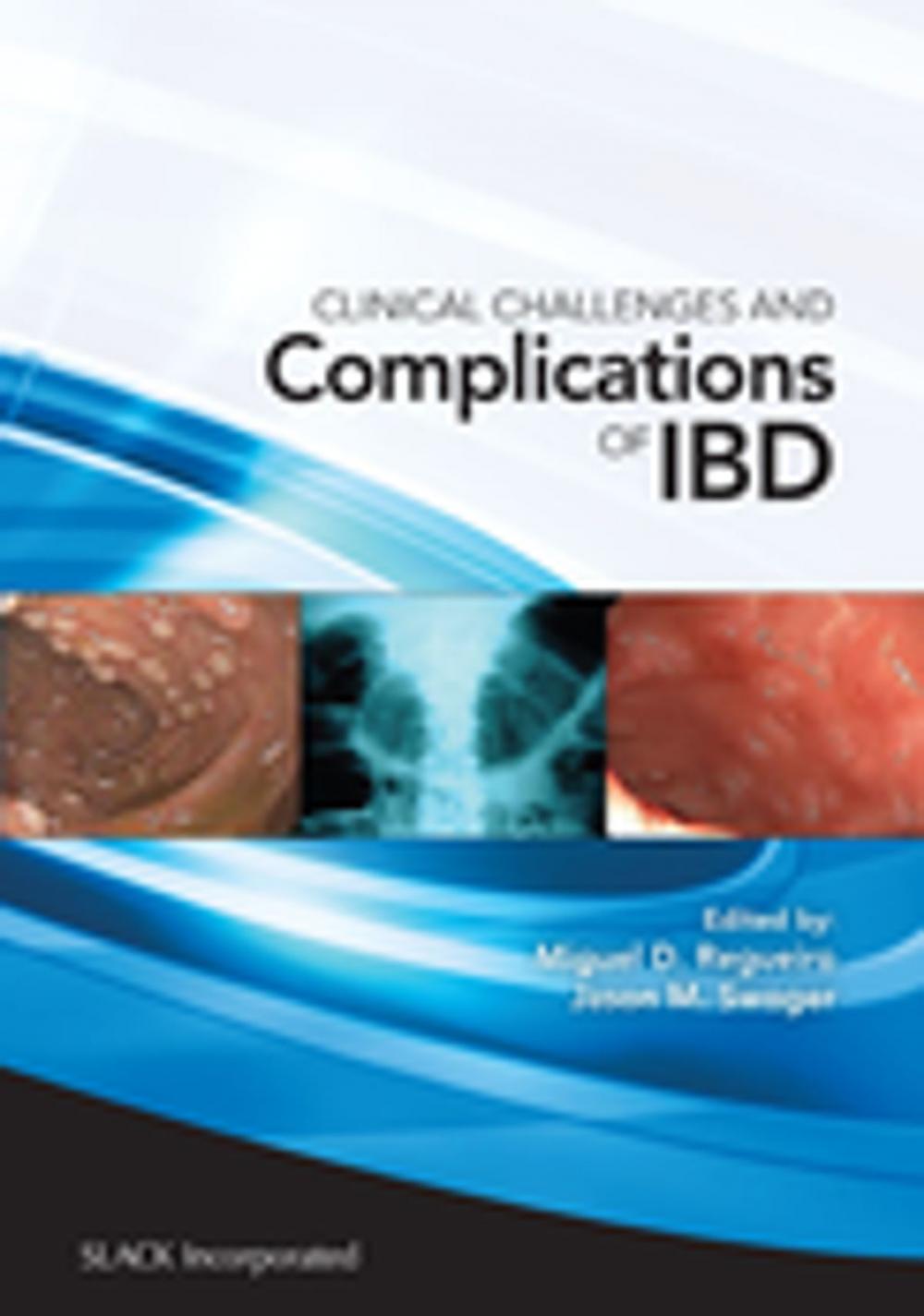 Big bigCover of Clinical Challenges and Complications of IBD