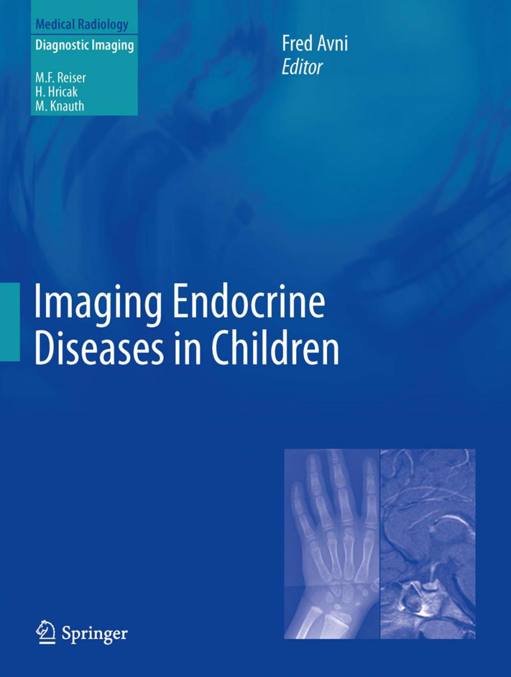 Big bigCover of Imaging Endocrine Diseases in Children