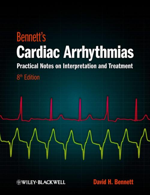 Cover of the book Bennett's Cardiac Arrhythmias by David H. Bennett, Wiley