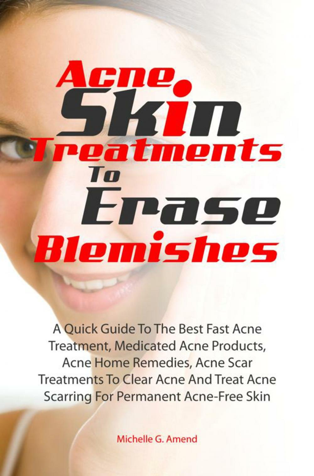 Big bigCover of Acne Skin Treatments To Erase Acne Blemishes