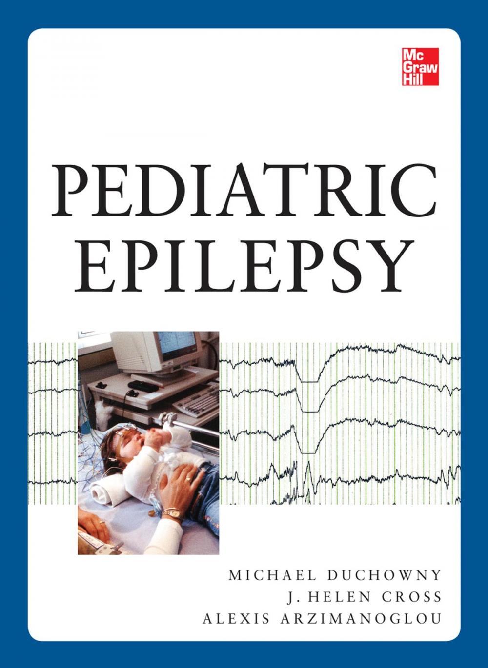 Big bigCover of Pediatric Epilepsy