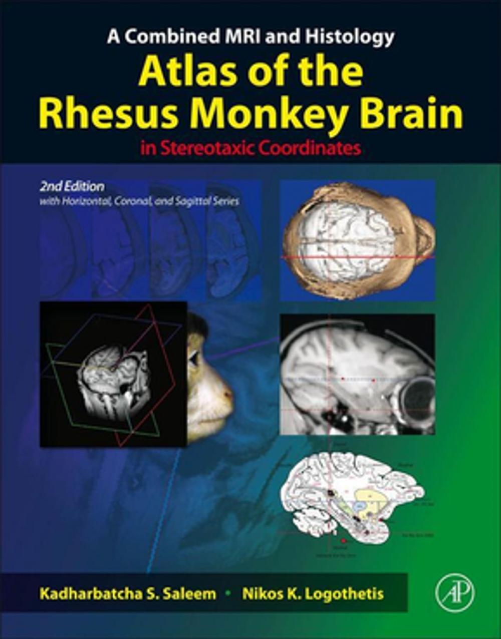 Big bigCover of A Combined MRI and Histology Atlas of the Rhesus Monkey Brain in Stereotaxic Coordinates