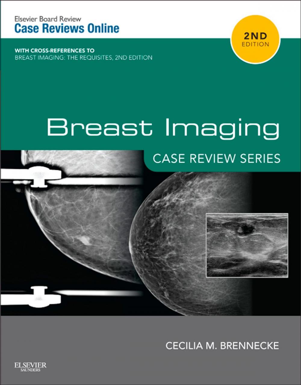 Big bigCover of Breast Imaging: Case Review Series E-Book