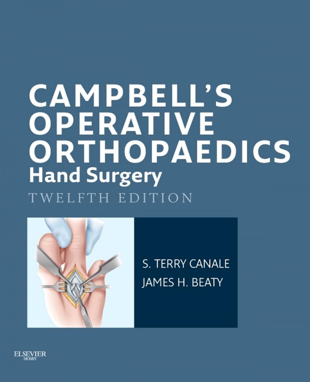 Big bigCover of Campbell's Operative Orthopaedics: Hand Surgery E-Book