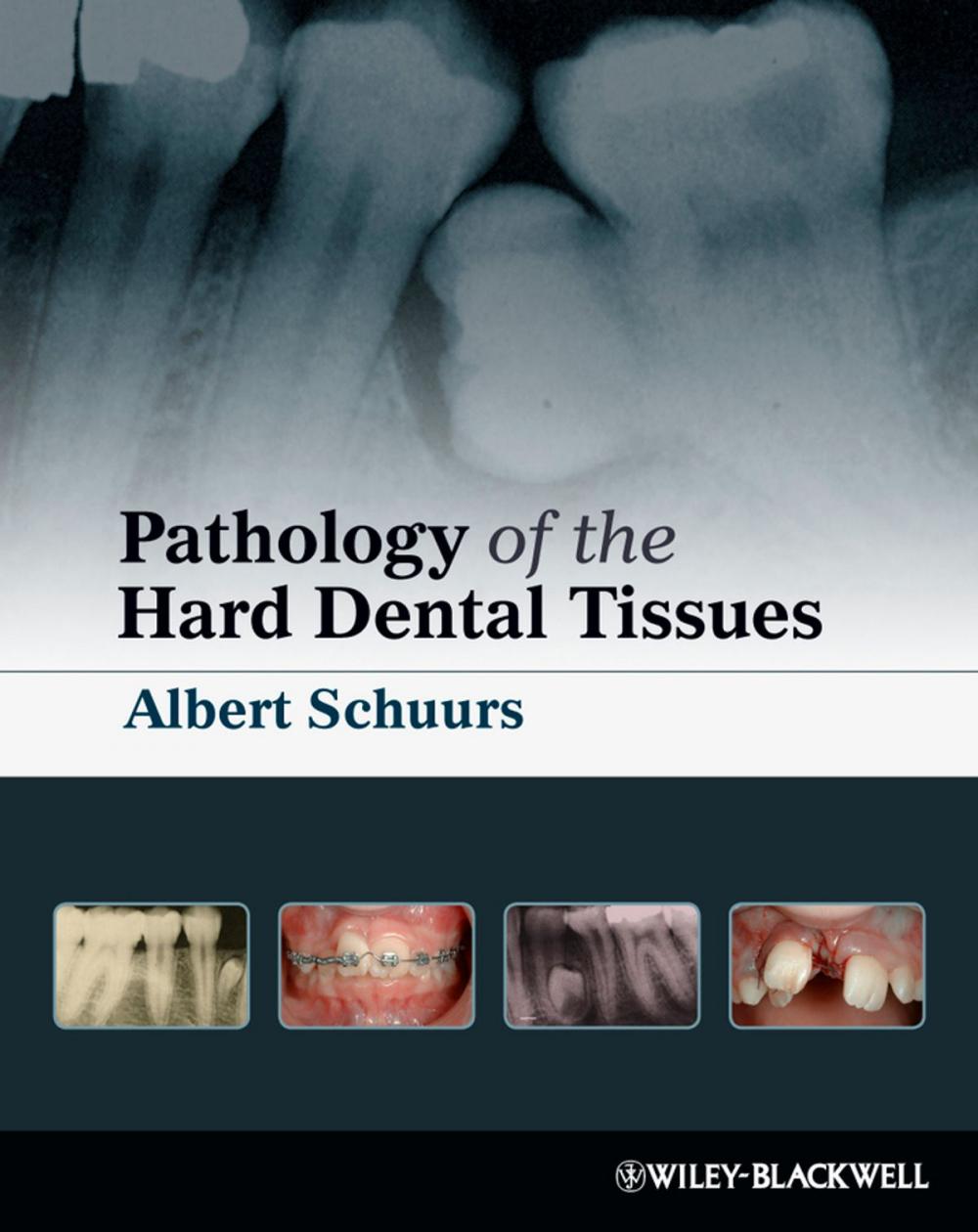 Big bigCover of Pathology of the Hard Dental Tissues