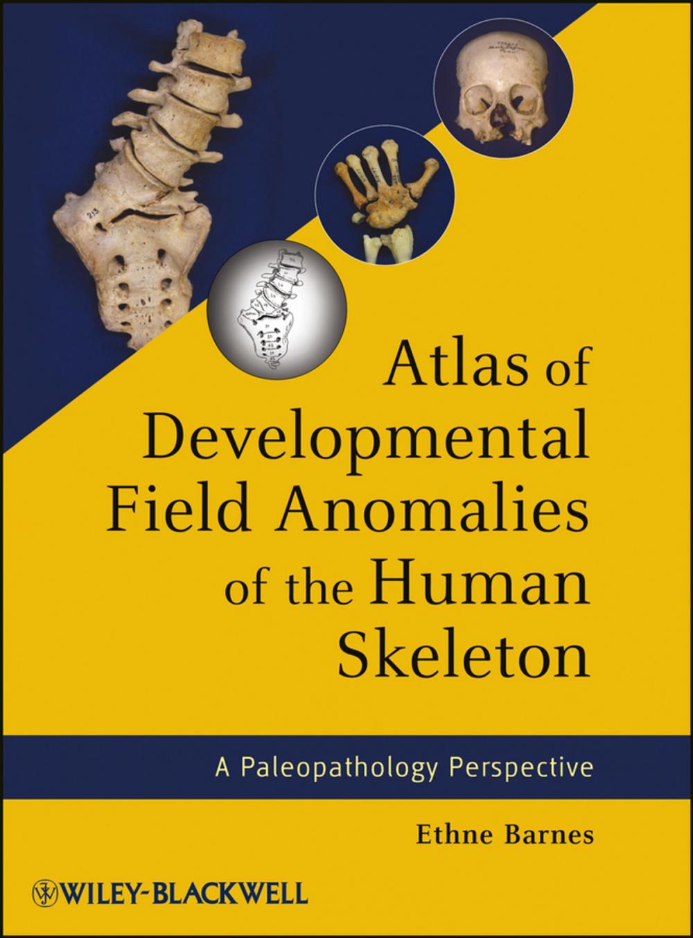 Big bigCover of Atlas of Developmental Field Anomalies of the Human Skeleton