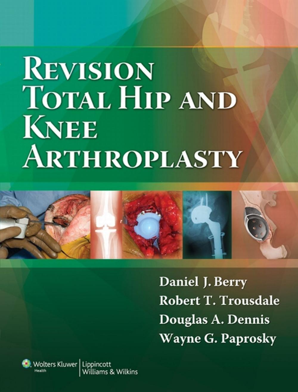 Big bigCover of Revision Total Hip and Knee Arthroplasty