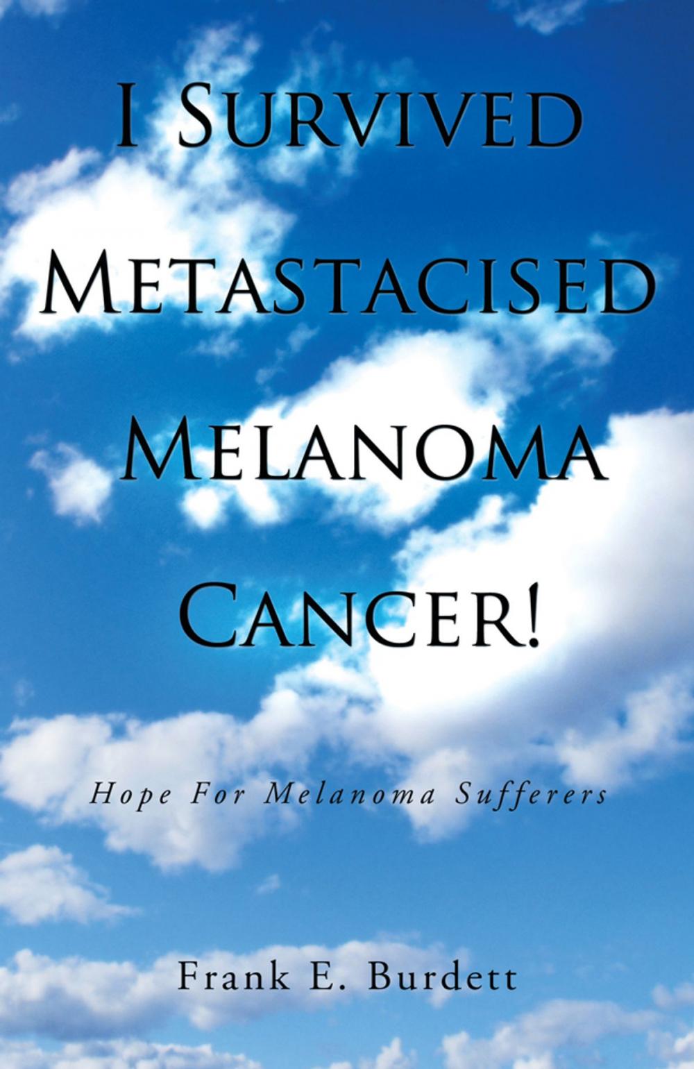 Big bigCover of I Survived Metastacised Melanoma Cancer!