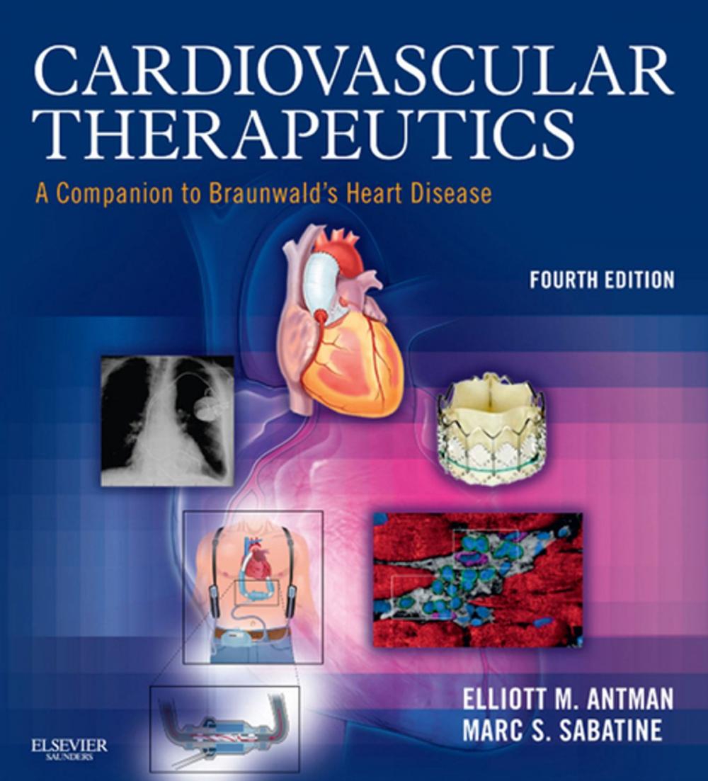 Big bigCover of Cardiovascular Therapeutics E-Book